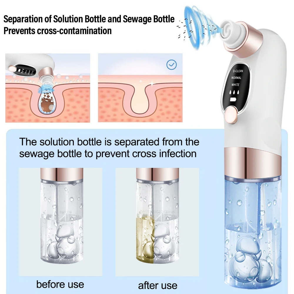 Blackhead Remover Pore Vacuum Cleaner Multifunctional Cleaning Instrument Small Bubble Facial Cleasing Machine Beauty Device - Image 2