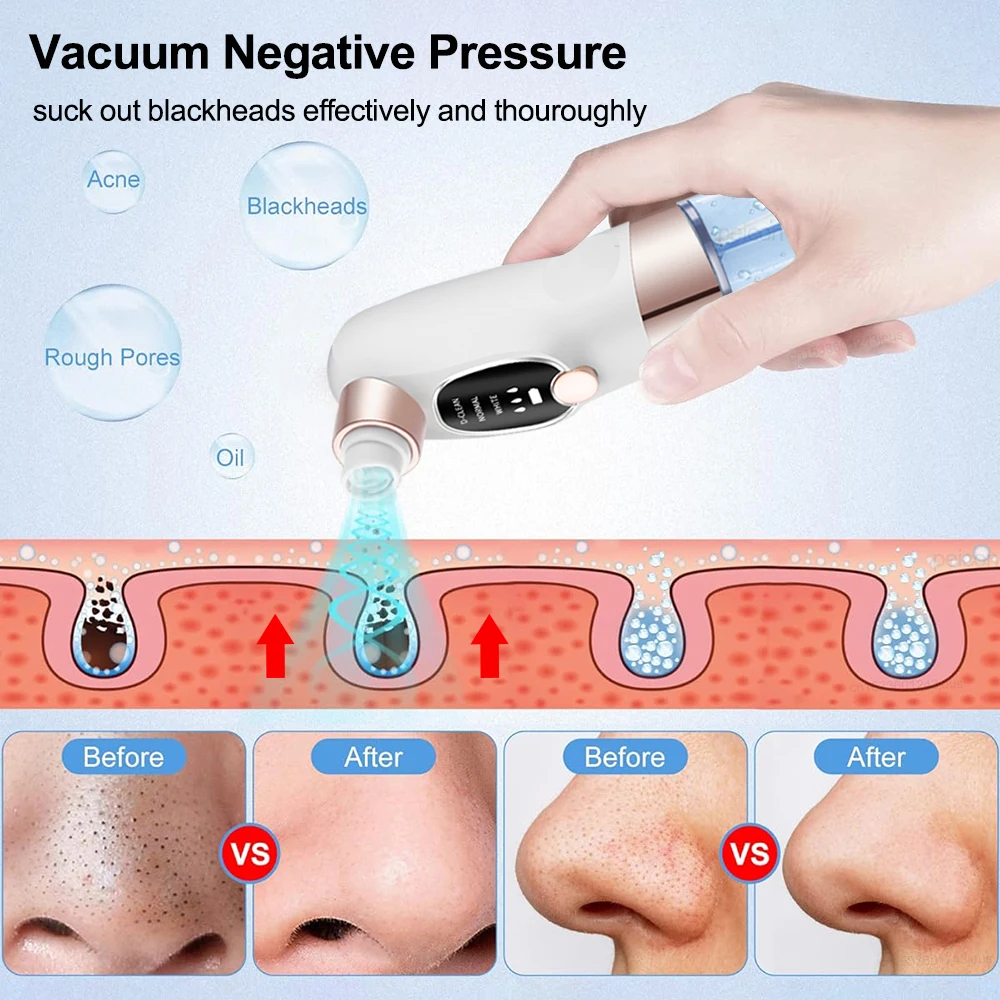 Blackhead Remover Pore Vacuum Cleaner Multifunctional Cleaning Instrument Small Bubble Facial Cleasing Machine Beauty Device - Image 4