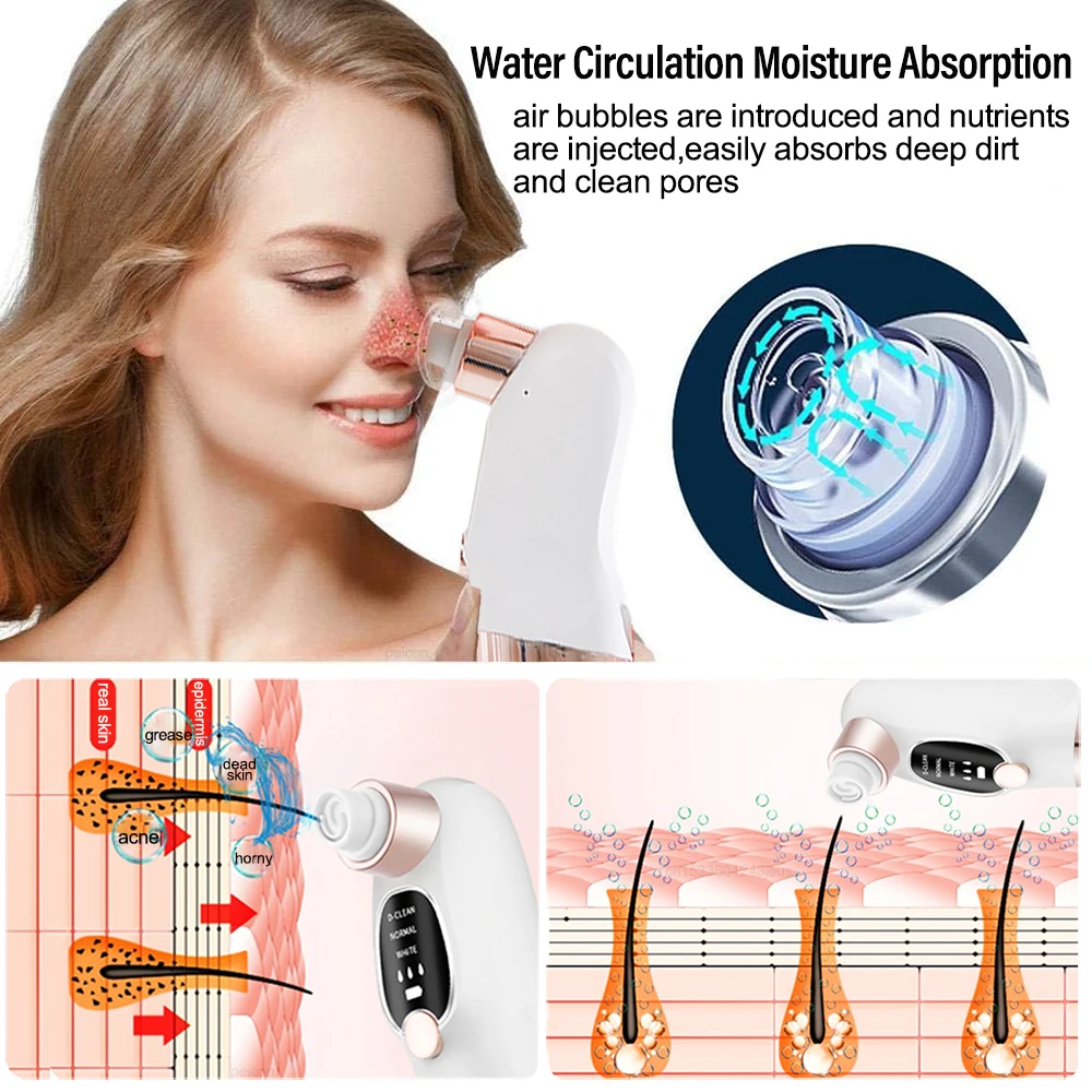 Blackhead Remover Pore Vacuum Cleaner Multifunctional Cleaning Instrument Small Bubble Facial Cleasing Machine Beauty Device - Image 5