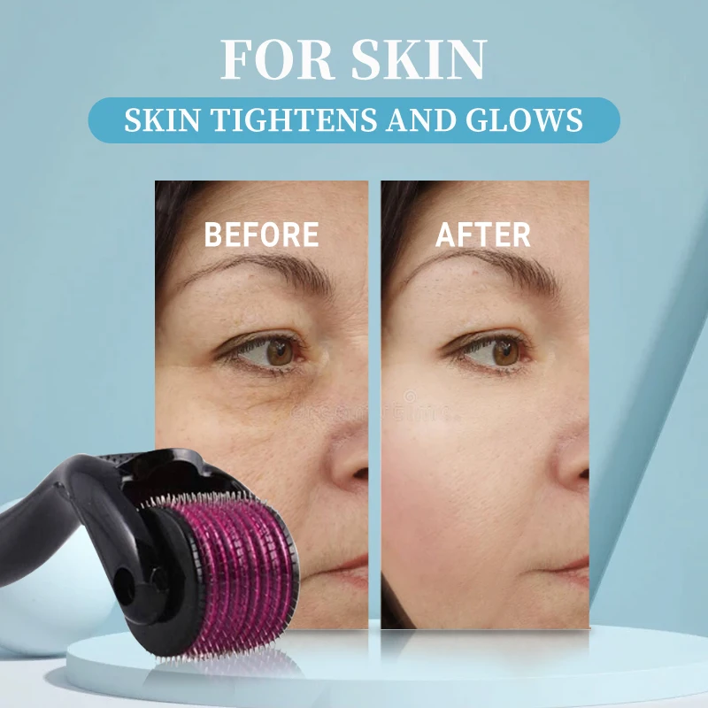 Micro Needling 540 Roller Derma Roller Professional Titanium Dermaroller 0.2/0.25/0.3mm Hair Regrowth Beard Growth Treatment - Image 4